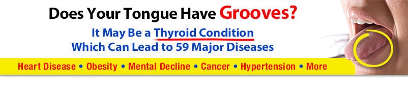 Thyroid Disorders Now Linked to 59 Major Diseases